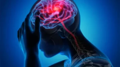 Gejala, Penyebab, serta juga Pencegahan Stroke Iskemik, Penyakit yang dimaksud Sebabkan Kematian Park Jin Ah