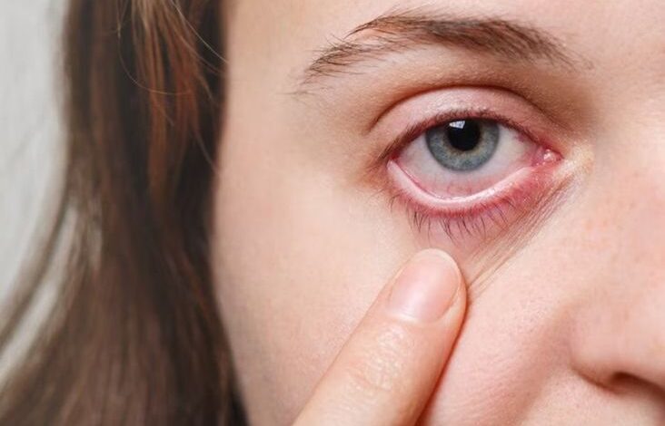 Mengenal Retinopati Diabetik, Penyakti Mata Akibat Diabetes