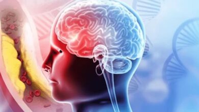 Kegunaan Penanganan Stroke Cepat, Jangan Lewati Golden Periode agar Pulih Lebih Baik