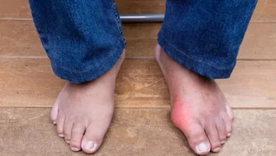 Penyebab Asam Urat pada Usia Muda, 5 Kebiasaan Tidak Baik Hal ini Harus Dihindari