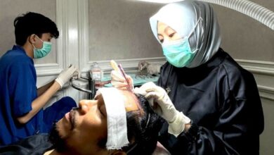 Indonesia Kembangkan Teknologi Hair Transplant Berstandar Internasional