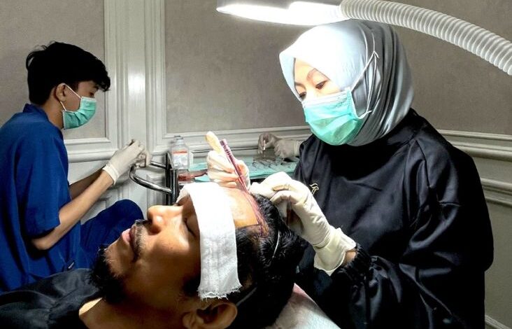 Indonesia Kembangkan Teknologi Hair Transplant Berstandar Internasional