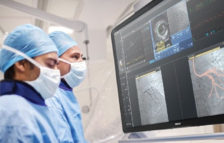 Inovasi Ultra-Low Contrast PCI Mungkinkan Pemerataan Layanan Kardiovaskular di Indonesia