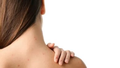 Tips Ampuh Menghilangkan Jerawat di dalam di Punggung, Harus Konsisten!