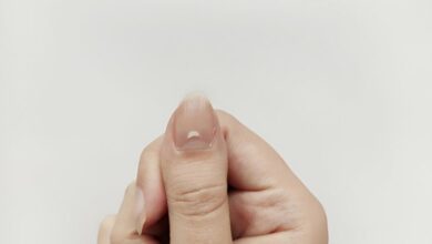 6 Perubahan Kuku yang Harus Segera Diperiksa, Muncul Lubang Tanda Rematik