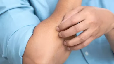 Ciri Gatal Ini adalah adalah Tanda Awal Diabetes yang dimaksud dimaksud Jarang Diketahui, Jangan Asal Garuk
