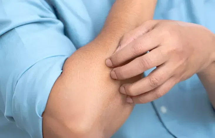 Ciri Gatal Ini adalah adalah Tanda Awal Diabetes yang dimaksud dimaksud Jarang Diketahui, Jangan Asal Garuk