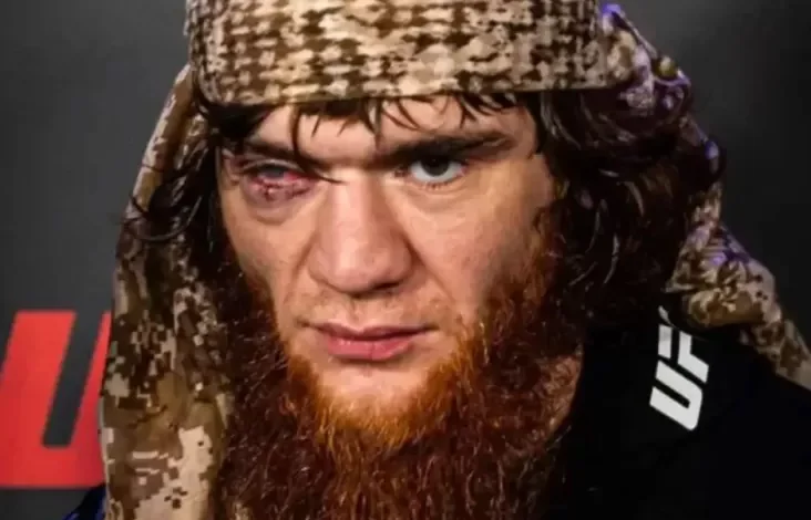 Kisah Petarung Mata Satu Sharabutdin Magomedov Kehilangan Matanya usai Operasi