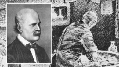 Profil Ignaz Semmelweis, Dokter yang dimaksud digunakan Dianggap Gila akibat Menyarankan Cuci Tangan bagi Tenaga Medis