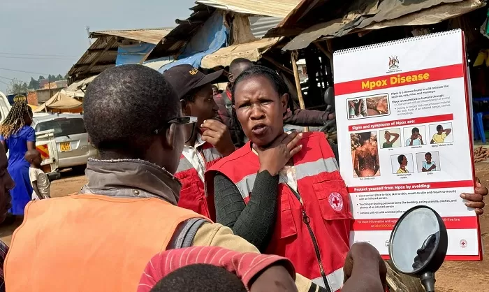 Bumi Waspada! Wabah Ebola Melanda Uganda, Bocah Berusia 4 Tahun Meninggal