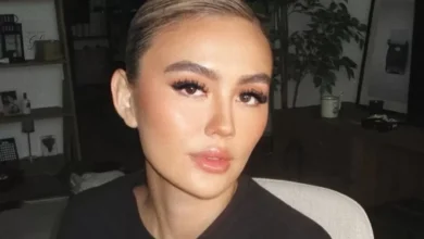 Mengenal Alopecia Areata, Penyakit yang dimaksud dimaksud Menjangkit Agnez Mo hingga Alami Kebotakan