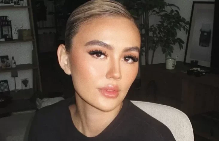 Mengenal Alopecia Areata, Penyakit yang dimaksud dimaksud Menjangkit Agnez Mo hingga Alami Kebotakan